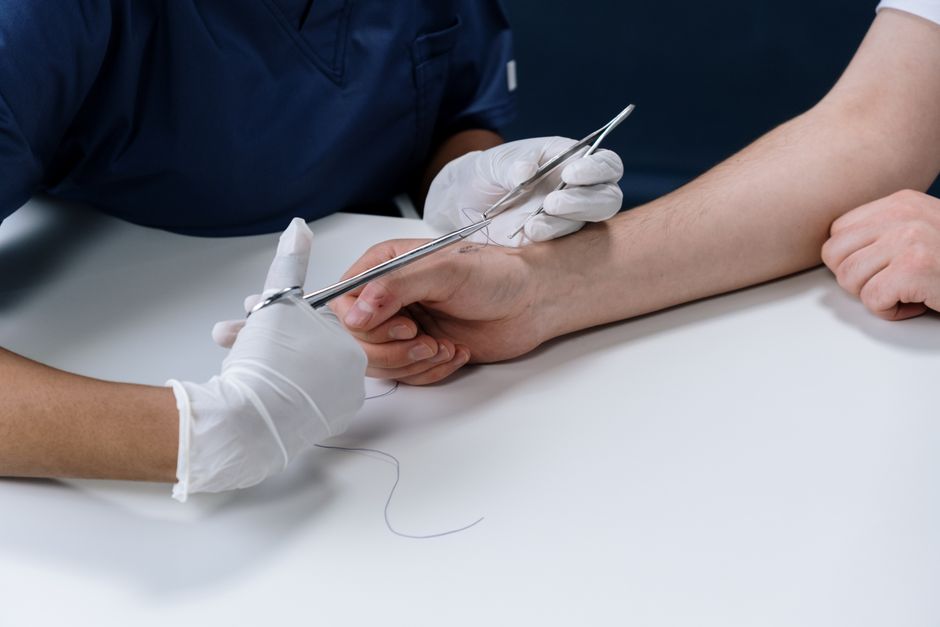 how do dissolving stitches work and how long they last