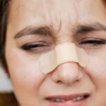 how do i know if my nose injury is serious