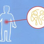 how do steroids affect the gut and microbiome