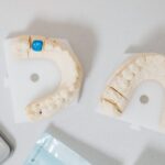 how do tooth crowns work procedure materials