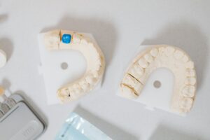 how do tooth crowns work procedure materials