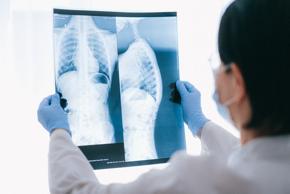 how do you get blood clots in your lungs