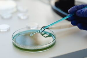 how doctors test for gut bacteria methods explained