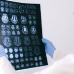 how does tourettes work the neuroscience of tics