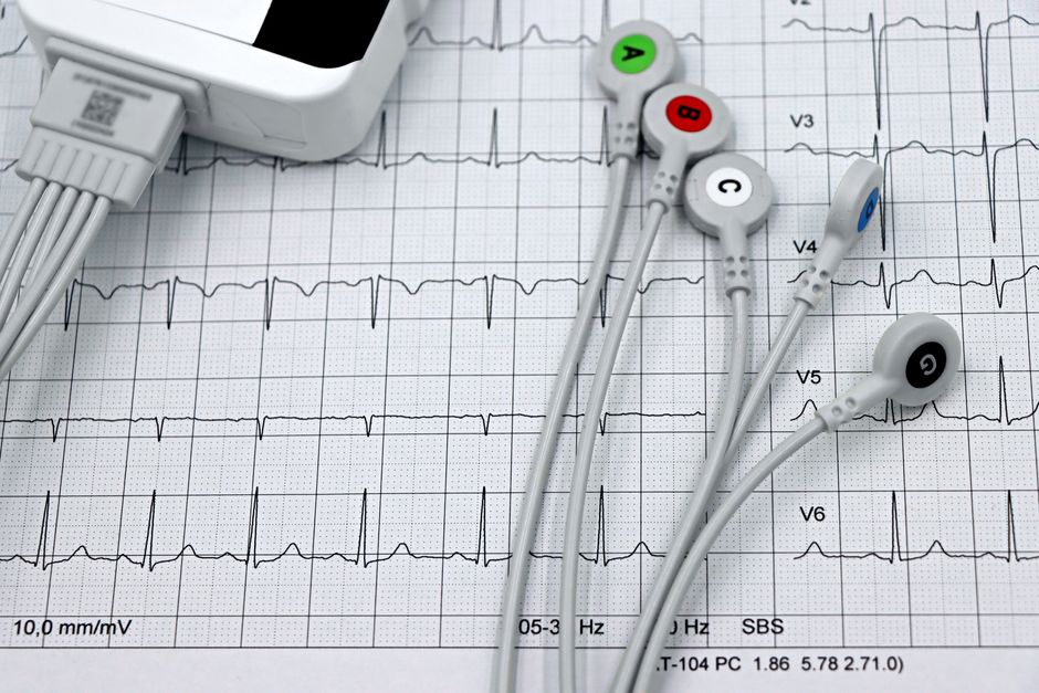 how is autoimmune encephalitis diagnosed key tests
