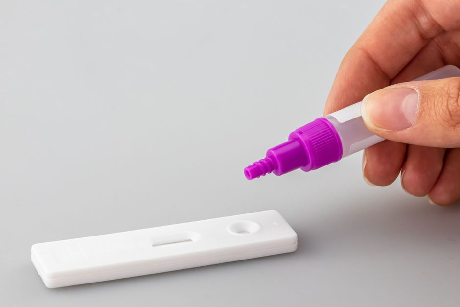 how long can a pee test detect alcohol