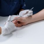 how long can sutures stay in