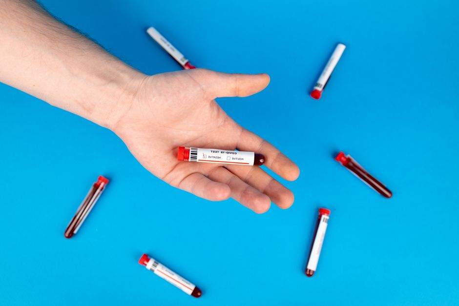 how long does a stool sample test take
