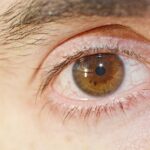 how long does conjunctivitis last