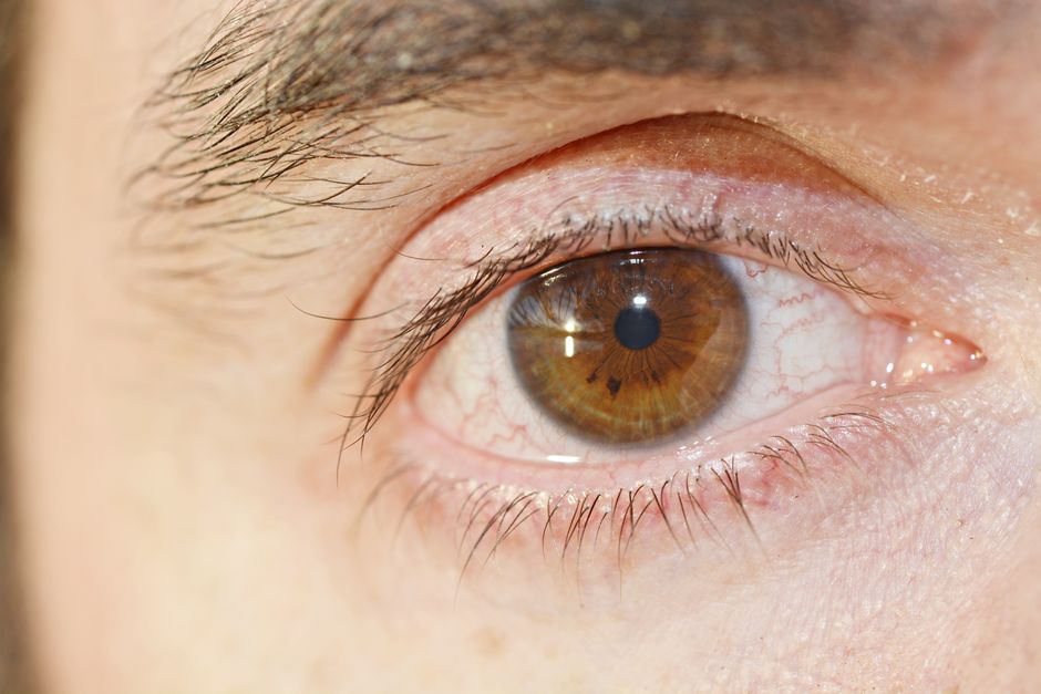 how long does conjunctivitis last