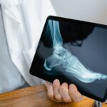 how many bones in the foot
