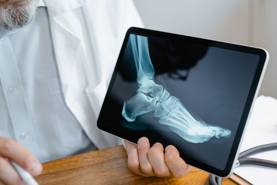 how many bones in the foot