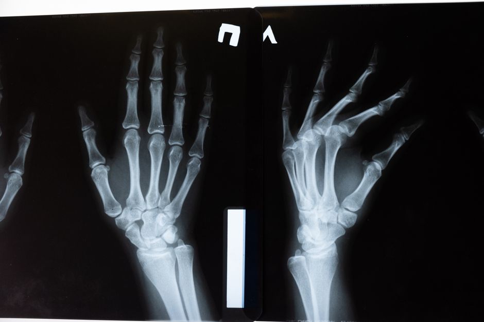 how many bones in the hand