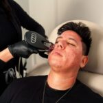 how many units for masseter botox dosing by goal