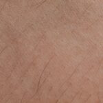 how the human hair follicle works