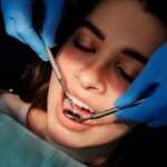 how to fix a chipped tooth bonding veneers more