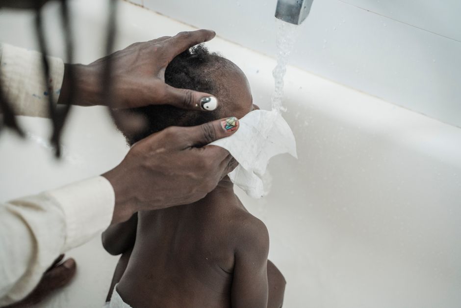 how to gently clean a babys face with eczema