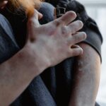 how to get asphalt off skin safely