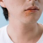 how to get rid of a cold sore quickly what works