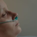 how to get rid of a transverse nasal crease naturally