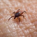 how to get rid of chiggers bites yard prevention