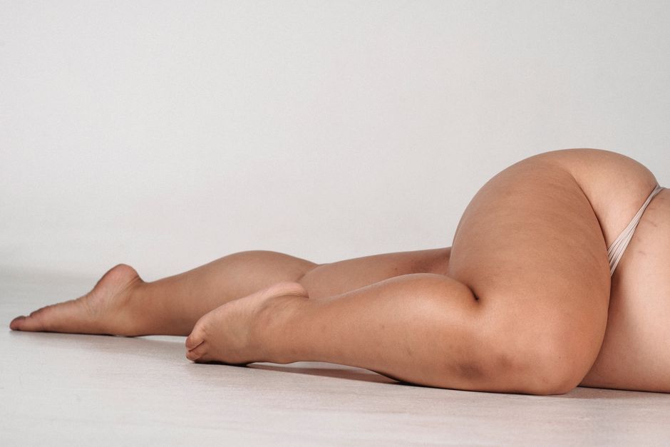 how to get rid of cottage cheese thighs what works