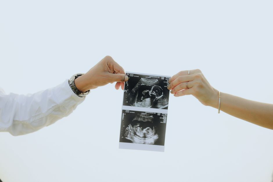 how to prepare for an mri scan what to expect