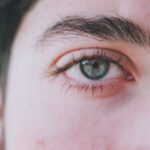 how to prevent a stye from coming back