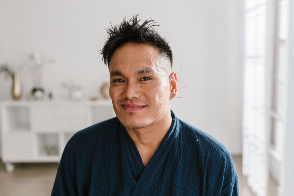 how to repair receding hairline
