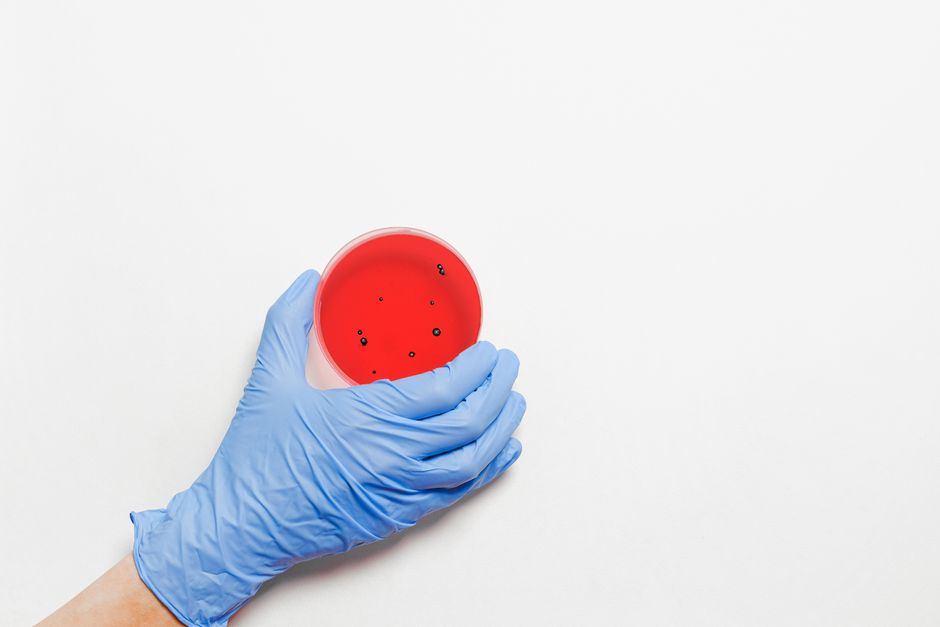 how to sterilize petri dishes at home or in a lab