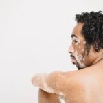 how to tell if tinea versicolor is healing