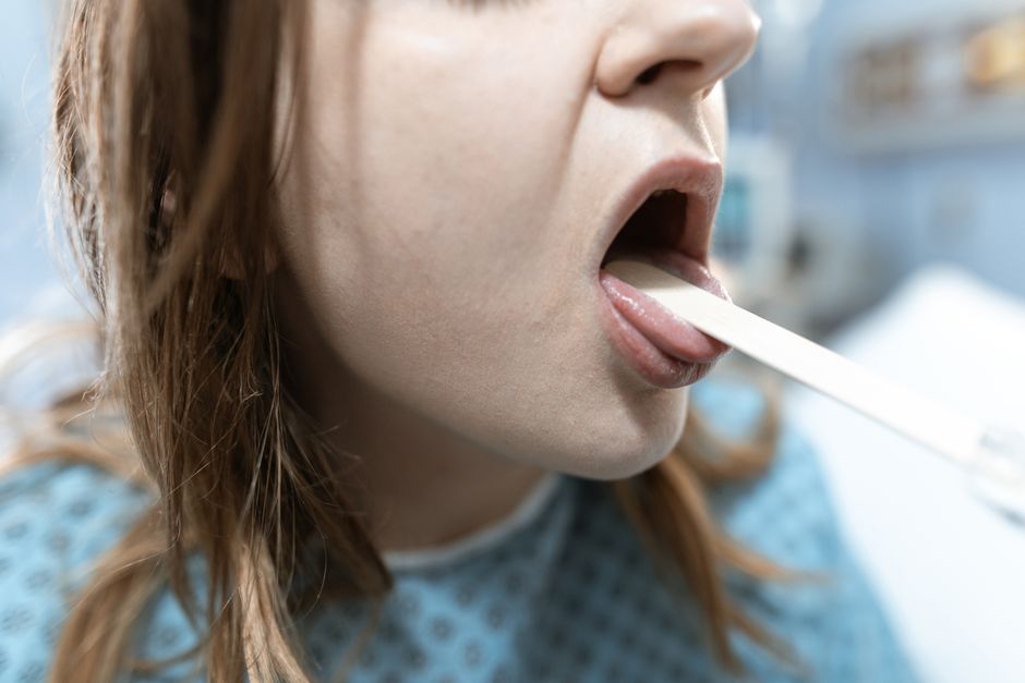 how to tell if you have a tongue tie at any age