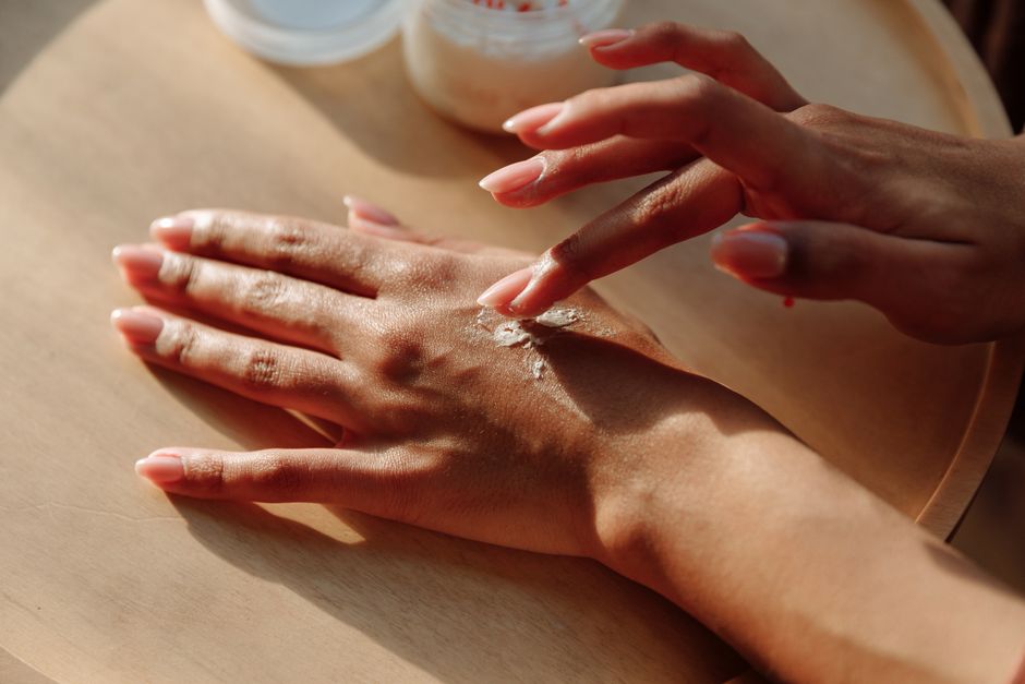 how to treat hand eczema creams to biologics