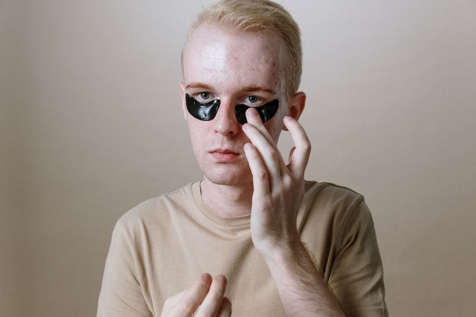 how to treat viral conjunctivitis what works