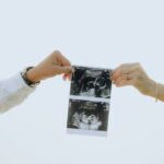 is baldness maternal or paternal what science says