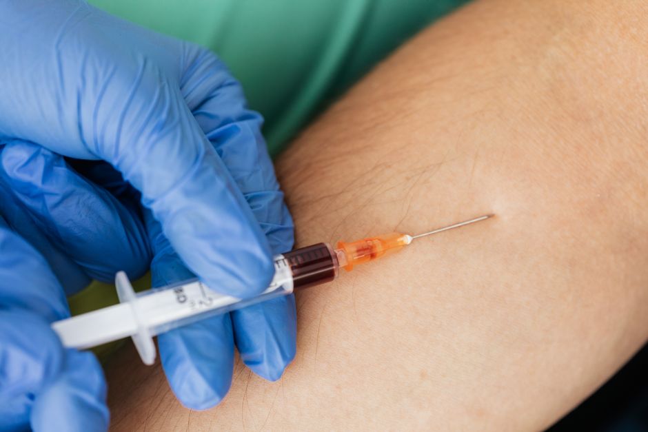 what are albumin and globulin blood proteins explained