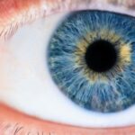 what are dilated pupils