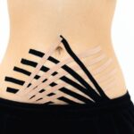 what are fascial adhesions and how do they form