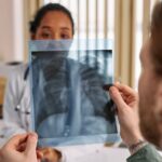 what are lung nodules