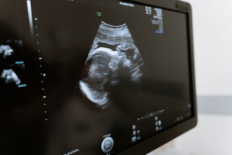 what are the three stages of pregnancy