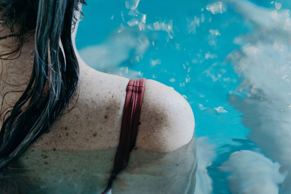 what causes a freckle