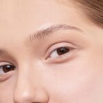 what causes changes in the periorbital region