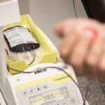 what causes low plasma volume and how is it treated