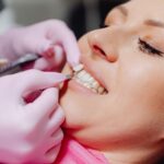 what do veneers feel like texture bite speech