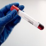 what does a blood test detect