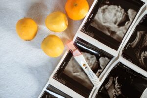 What Does An Ultrasound Show? 5 what does an ultrasound show