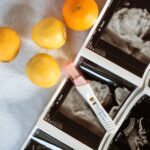 what does an unremarkable renal ultrasound mean