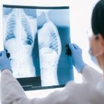 what does asbestos do to your body and lungs