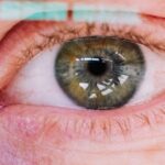 what does dcis look like on mri enhancement patterns