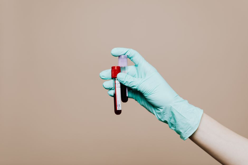 what does low co2 mean in blood tests
